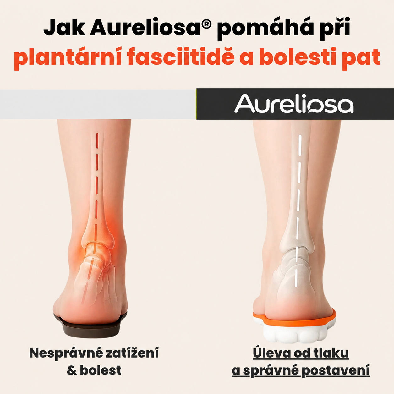 Aureliosa® Ortopedické vložky